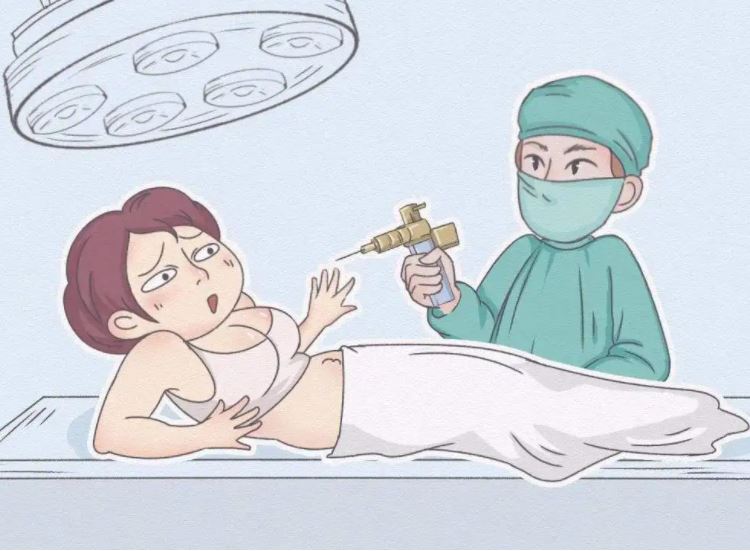 全身抽脂對身體有什么傷害？