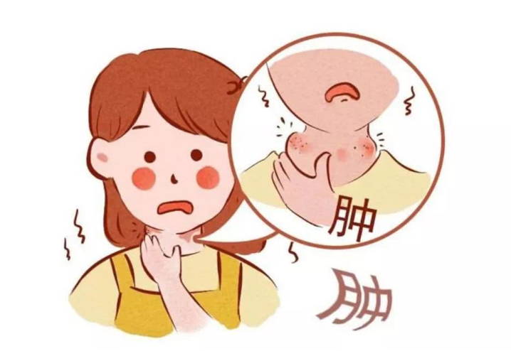 扁桃體發(fā)炎吃什么藥好得快？扁桃體發(fā)炎飲食禁忌有哪些？
